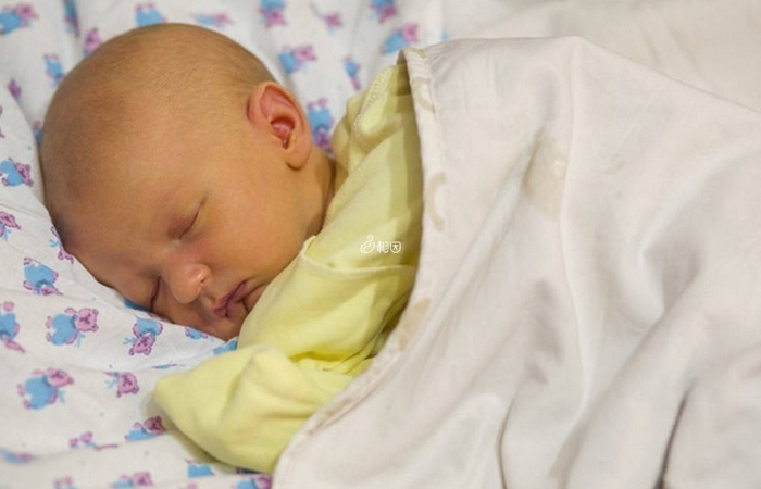 宝宝出生后可能会出现母乳性黄疸的情况