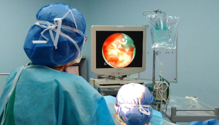 宫腔镜手术操作技巧不足可能引发内膜炎