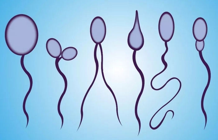 异常形态精子是指男性精液中所包含的精子形态存在畸形