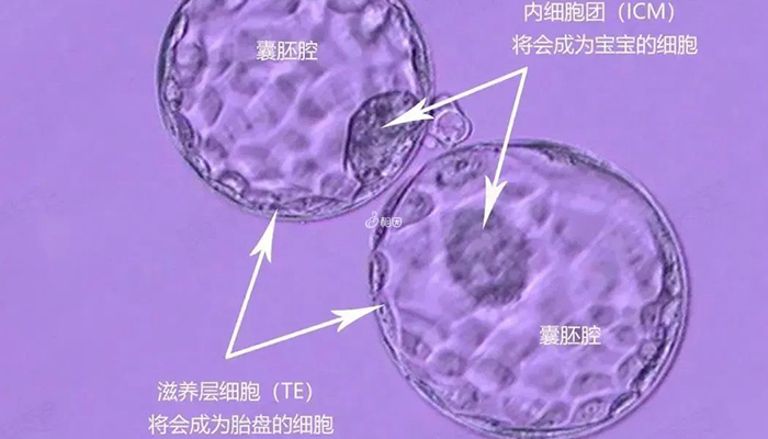 囊胚由三部分来进行级别划分