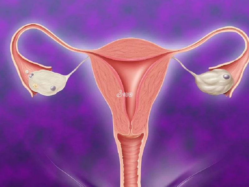 腺肌症患者需要先改善子宫环境
