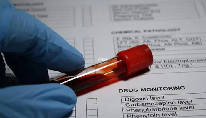 孟买血型检测提供血液标本及唾液标本即可