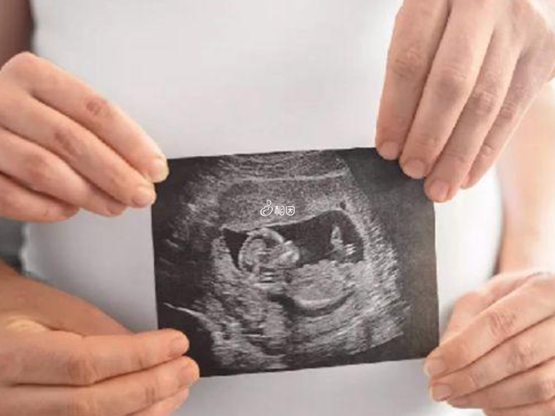 孕16周胎儿生殖器开始逐渐发育
