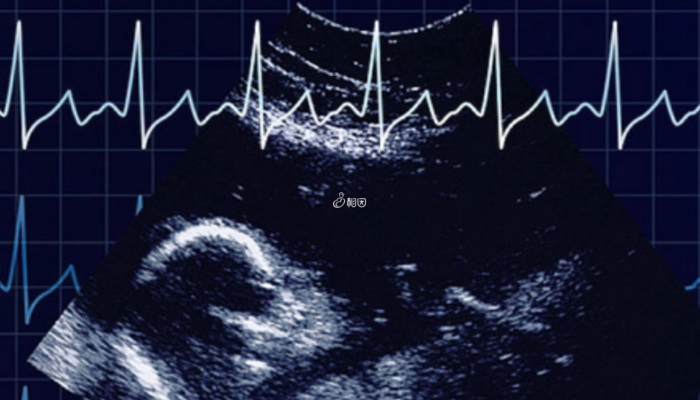 胎心异常要注意胎儿是否缺氧了