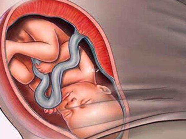 胎儿入盆