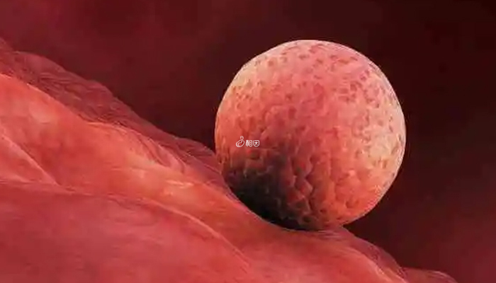 子宫内膜异位症会影响胚胎着床