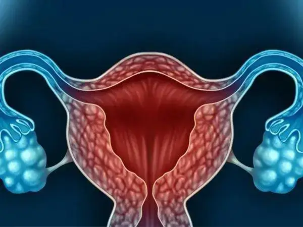 卵巢异常会影响取卵