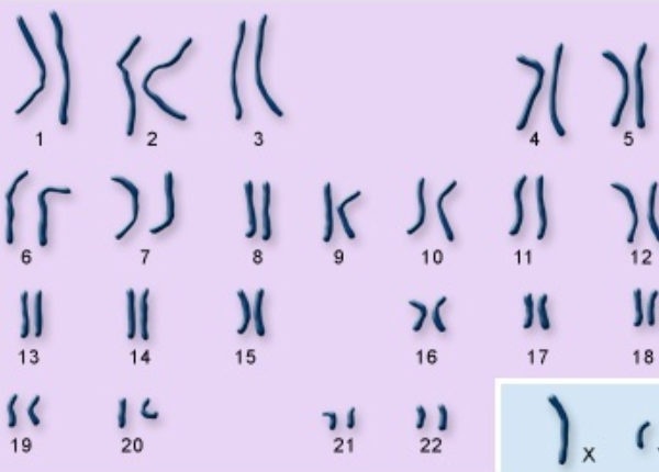 染色体检查是基因检测中的一项