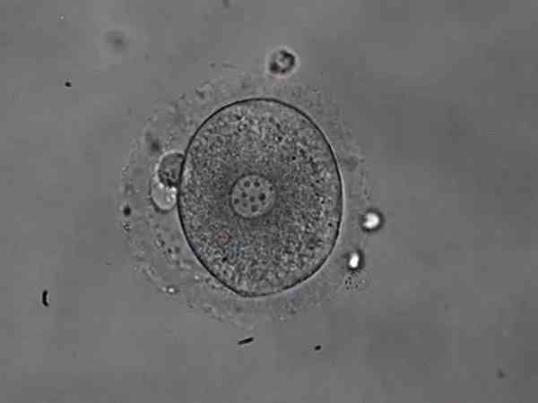 1pn是异常授精的胚胎