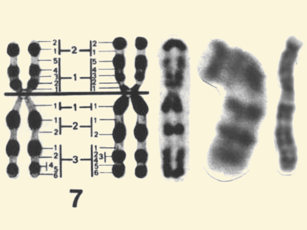7号染色体