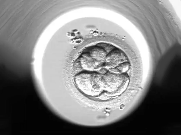 试管移植后立刻排尿不会排出胚胎