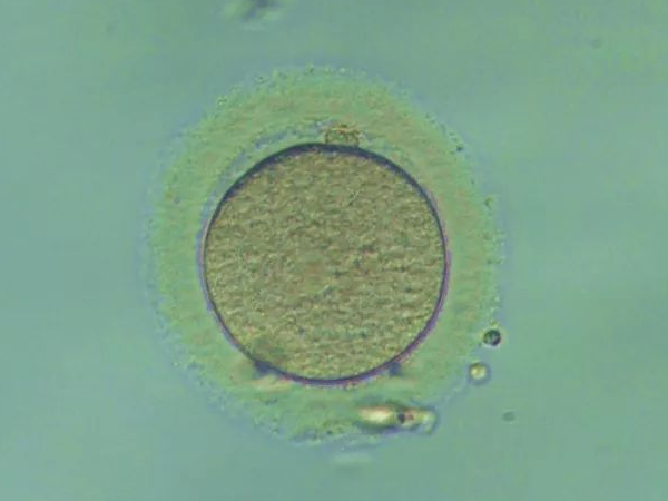 优质胚胎养囊成功率高