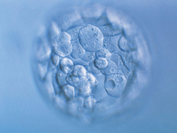鲜胚着床时可能存在轻微腹痛