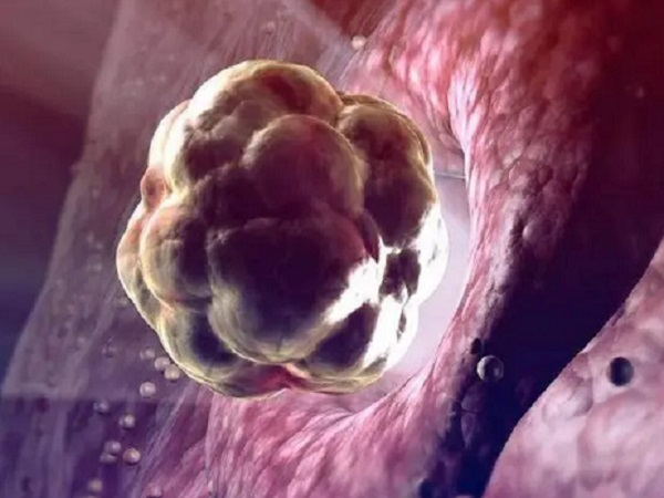 胚胎在子宫内着床时会刺激内膜