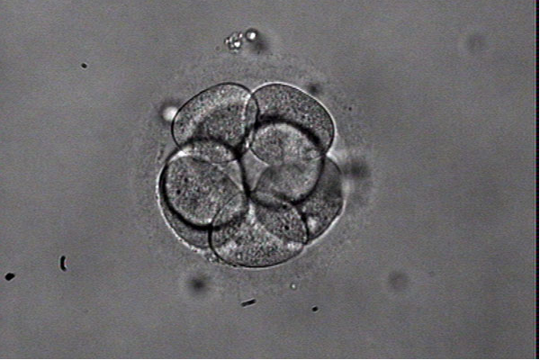 4bb囊胚是优质胚胎