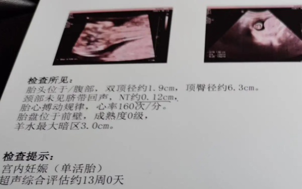 孕29周胎儿双顶径平均值为7.50厘米