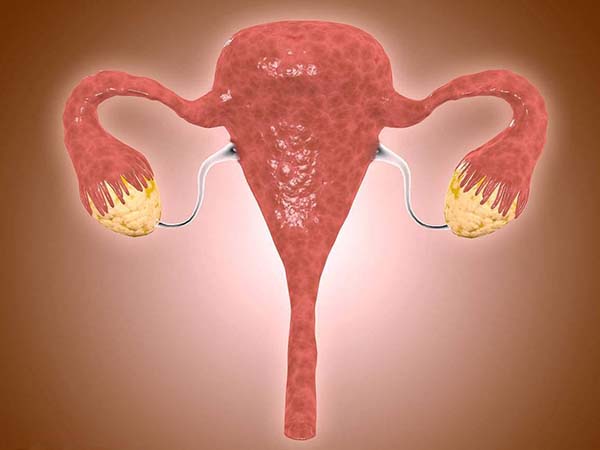 拮抗剂方案能减少卵巢刺激