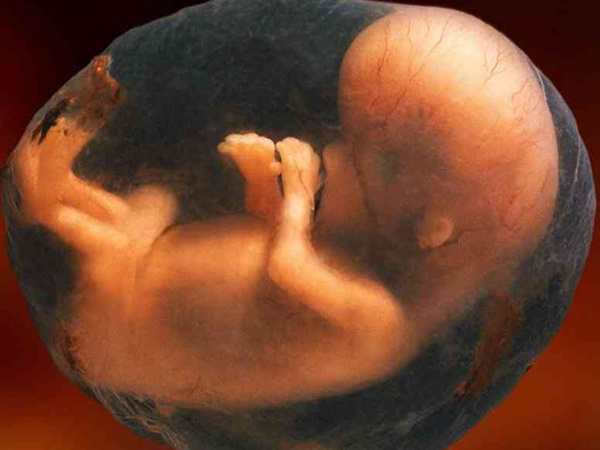 孕检胎儿头大是不是生女孩