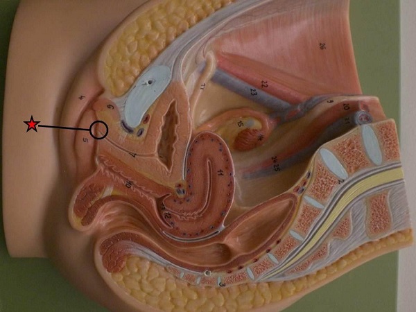 阴道壁松弛是做凯格尔运动的危害