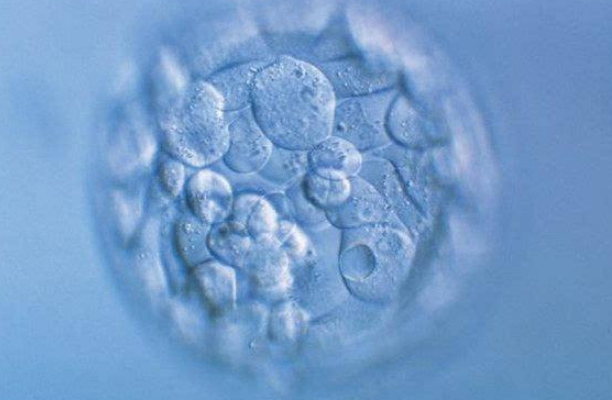 胚胎质量会影响试管一超的结果