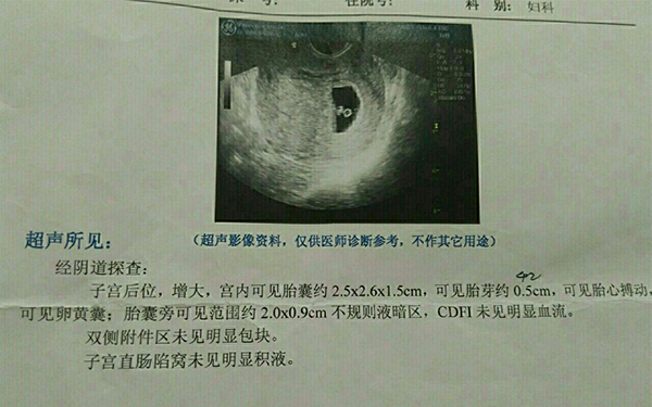 检査孕囊的目的主要是看胎儿发育情况