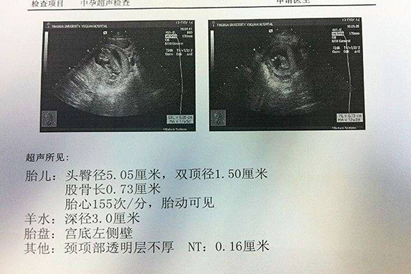 验血和b超查男女误差率大