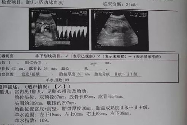 通过四维图识别是否是女宝不可信