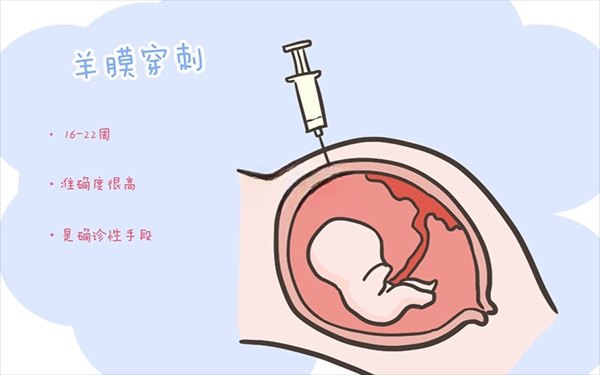 羊水穿刺的最佳时间一般是在怀孕20周