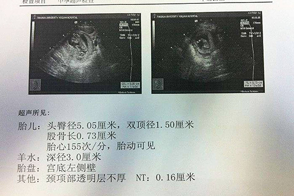 B超检查报告单