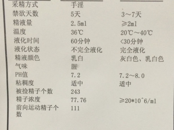 冻精前做精液常规检查