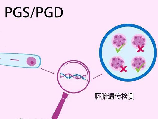 三代试管可降低染色体异常风险