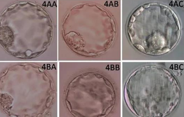 4bc囊胚可以移植