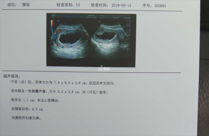 清宫表的怀孕日期是以受孕当天为准