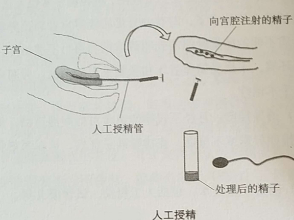 王苗苗擅长人工授精