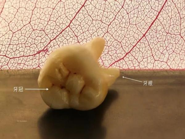 4个月长牙聪明是谣传