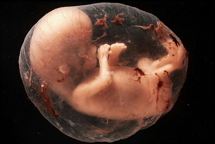胎儿缺氧会危及孩子健康和生命