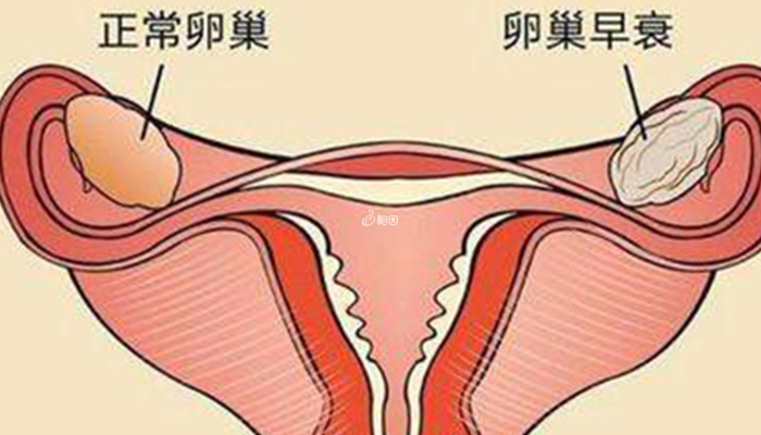 卵巢早衰会表现为月经不调