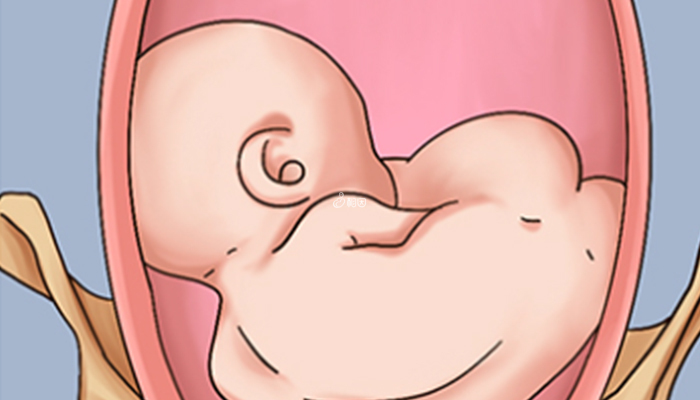 胎位异常要剖宫产