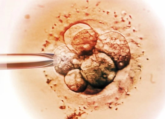 基因的问题影响胚胎的质量