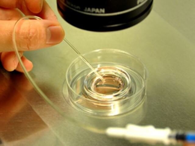 和田做二代试管胚胎移植成功率为45%